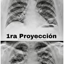Radiografía 8